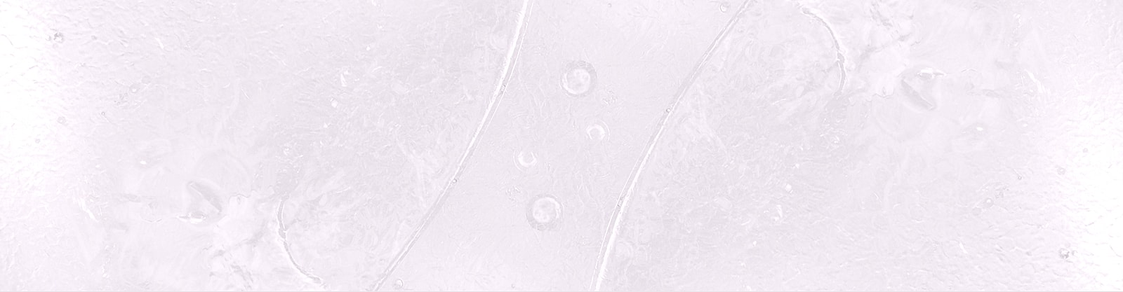 Abstract texture with subtle patterns and bubbles.